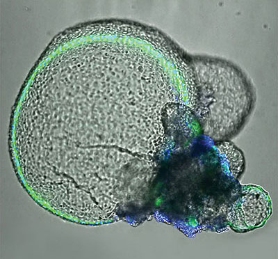 CRISPR Jump-Starts Gene Therapy
