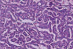 Tumor Models Bridge Mouse-Human Gap