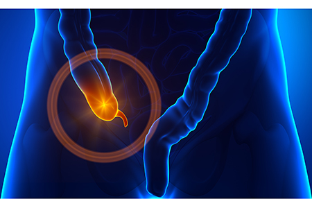 Parkinson's Disease, Your Appendix, and the Microbiome