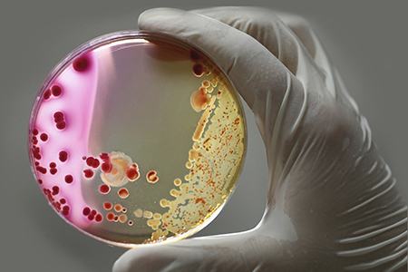 How Antibiotics Affect Your Microbiome