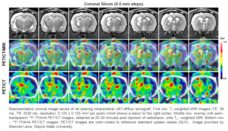 Rodent Brain Coronal Slices