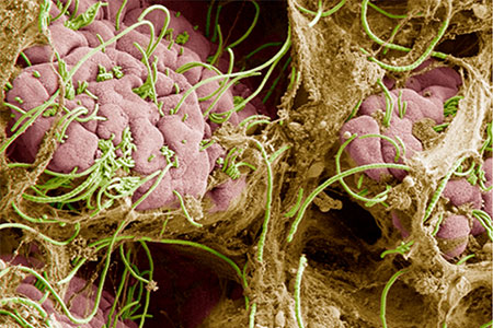 A First-Person Account of the Microbiome Revolution