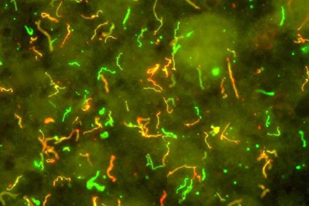 Lyme Disease Bacteria, Borrelia burgdorferi