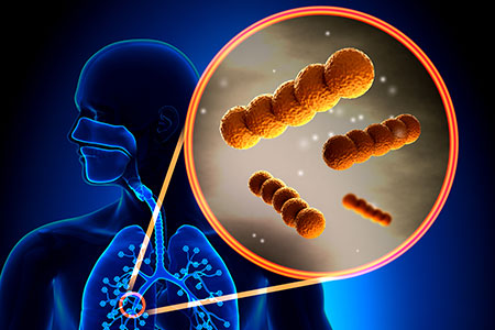Murine Lung Microbiome Webinar Recap