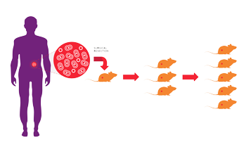 Patient Derived Xenografts (PDX) an in vivo oncology model