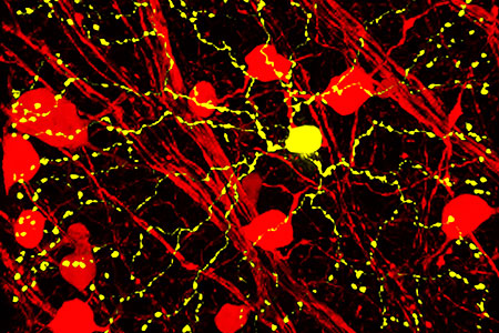 Which Cre Strain Should You Use?