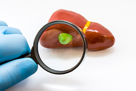 Hand in glove examine with magnifying glass gallbladder on liver