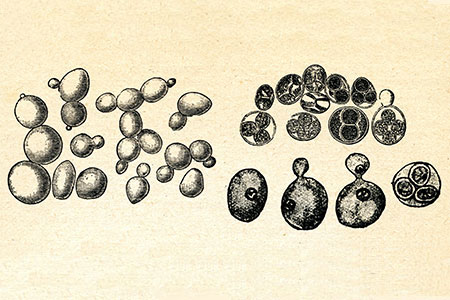 Yeast Worsens Disease in a Mouse Model of Colitis