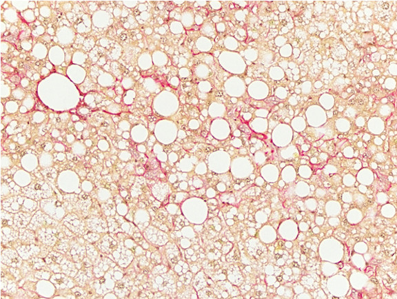 Microscopic Image of model's cells