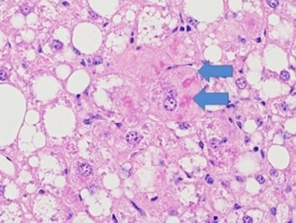 Microscopic Image of model's cells